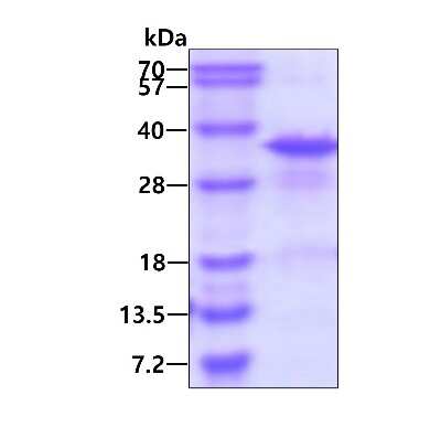 SDS-PAGE: Recombinant Human RPL8 His Protein [NBP1-99077]